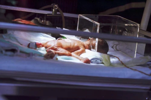 Abortion in the Case of Medical Diagnoses