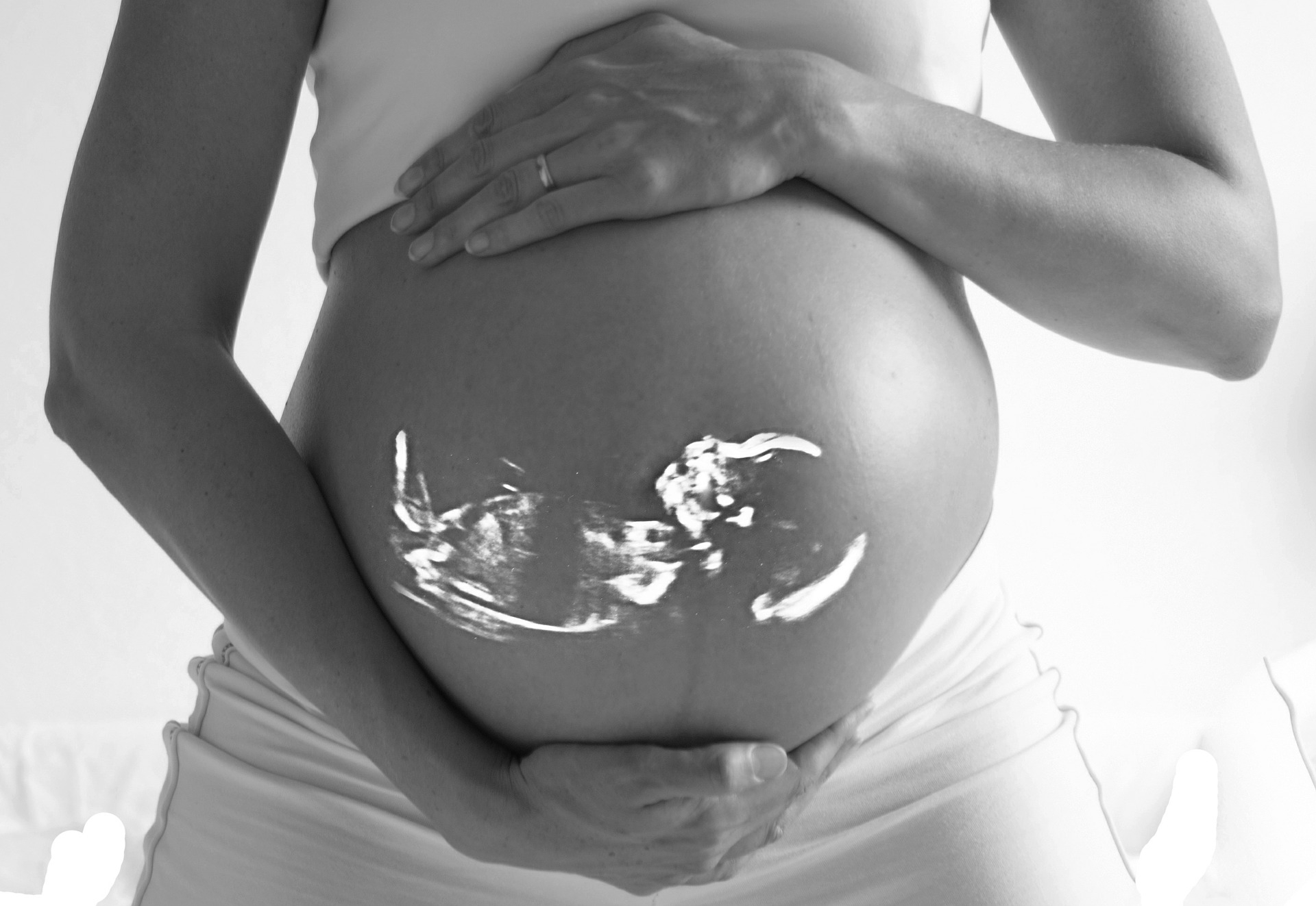 SB67 Disposition of Fetal Remains