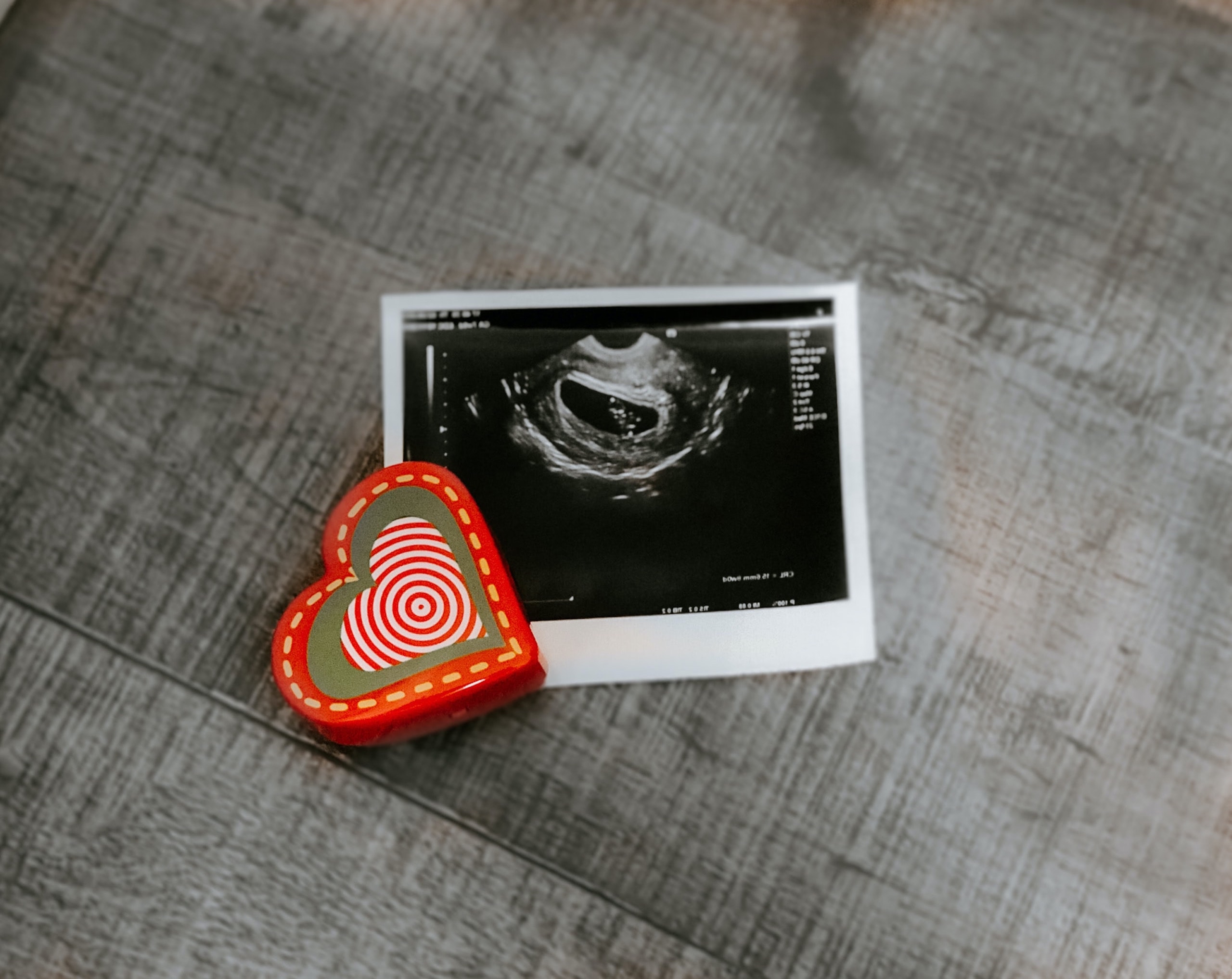 When You Say “Pro-Choice,” You’re Really Saying “Pro-Abortion.” Here’s Why.